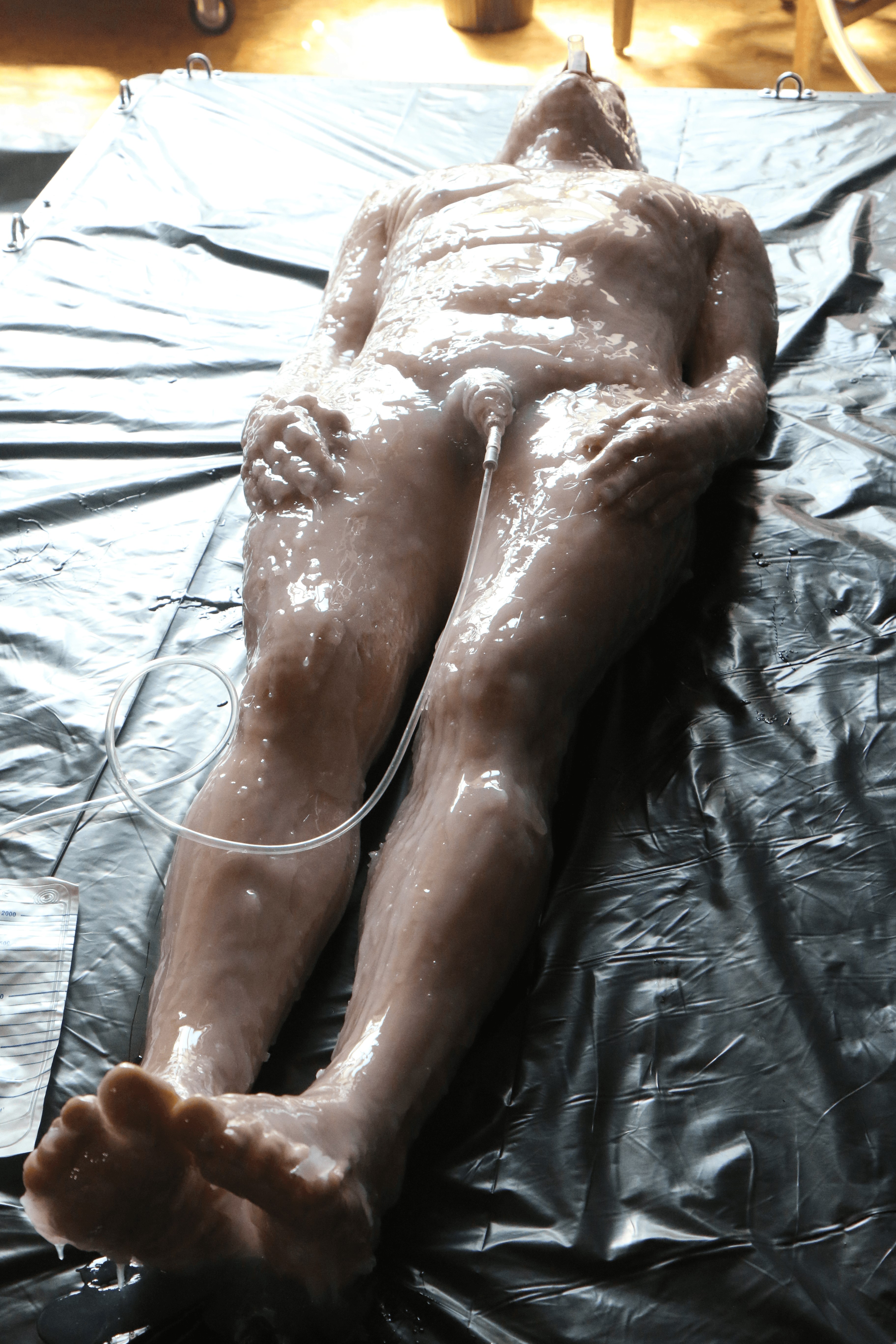 Silicone Encasement: Part Two