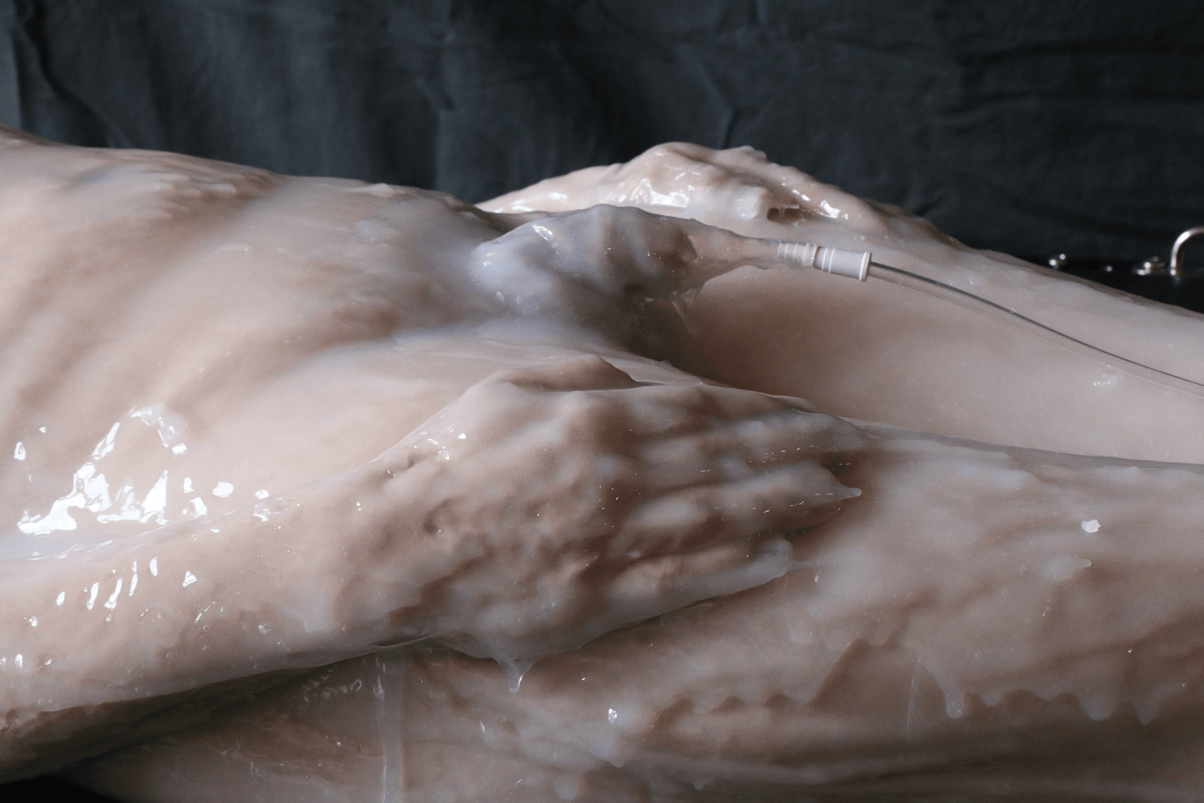 Silicone Encasement: Part Two