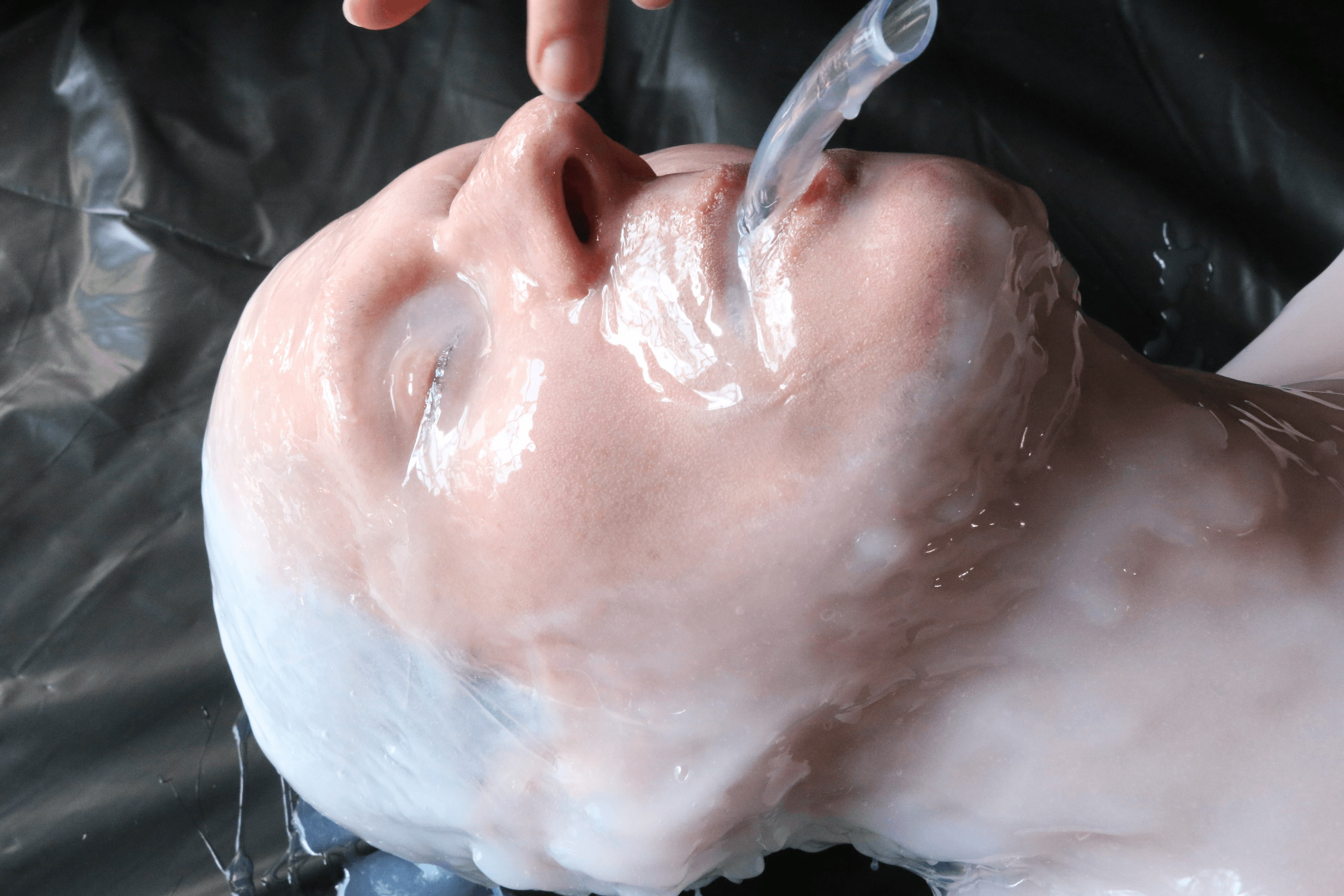 Silicone Encasement: Part Two